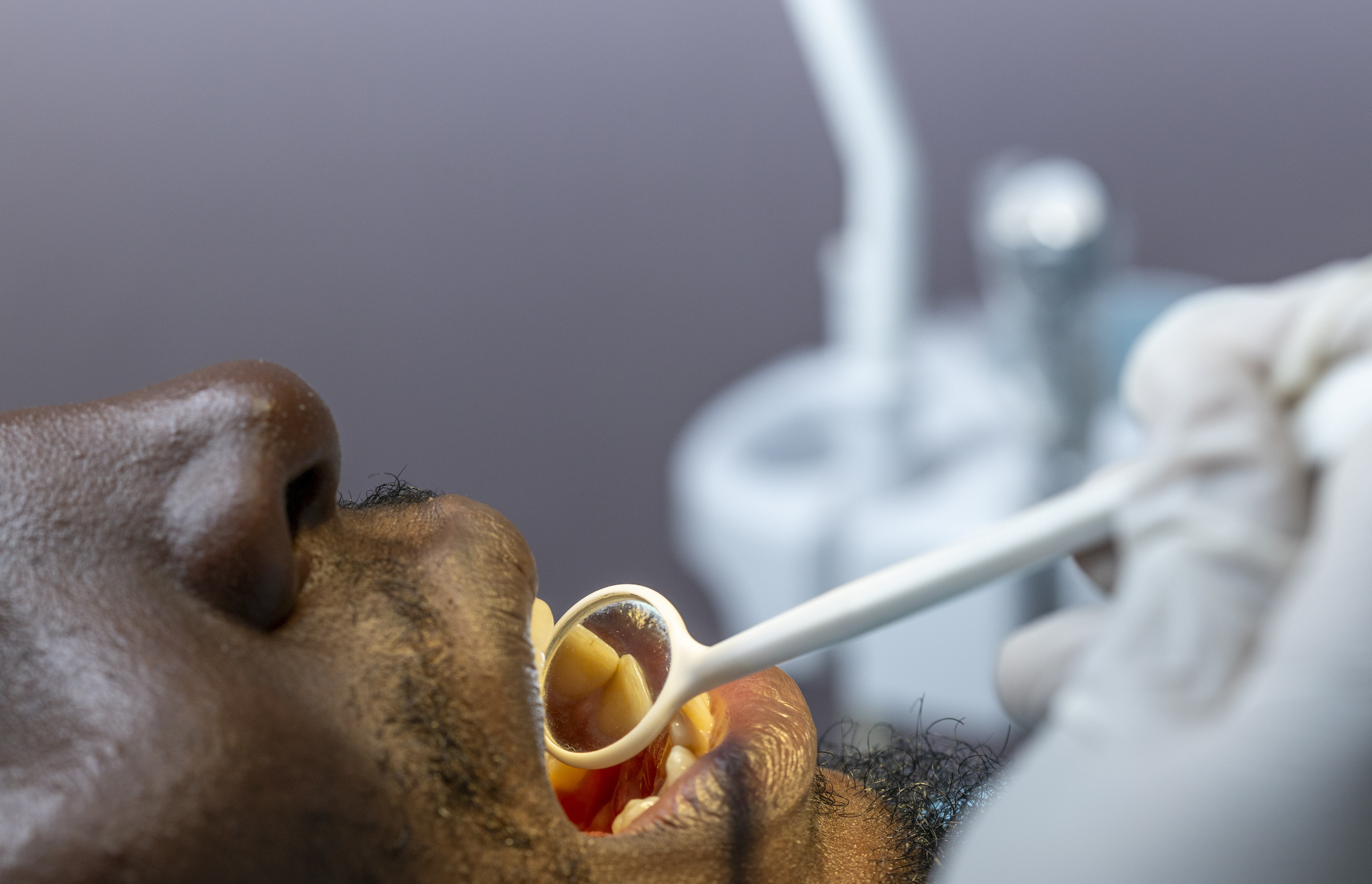 Românii din Germania aleg implanturile dentare în România: cum se planifică corect tratamentul